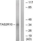 Anti-TAS2R10 antibody produced in rabbit affinity isolated antibody
