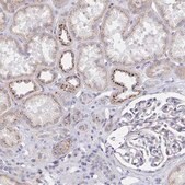 Anti-MAN1A1 antibody produced in rabbit Prestige Antibodies&#174; Powered by Atlas Antibodies, affinity isolated antibody, buffered aqueous glycerol solution
