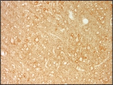 Monoclonal Anti-Glutamic Acid Decarboxylase 67 (GAD67) antibody produced in mouse clone K-87, purified antibody