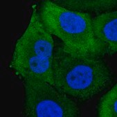 Anti-AKR1B10 antibody produced in rabbit Prestige Antibodies&#174; Powered by Atlas Antibodies, affinity isolated antibody, buffered aqueous glycerol solution