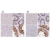 Anti-CSE1L antibody produced in rabbit Prestige Antibodies&#174; Powered by Atlas Antibodies, affinity isolated antibody, buffered aqueous glycerol solution