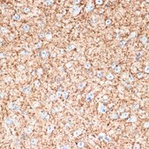 Anti-VAMP1 antibody produced in rabbit