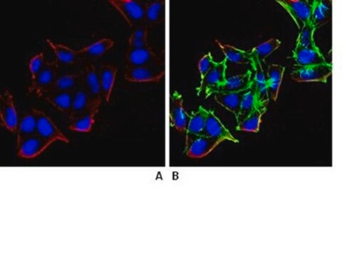 Anti-beta Arrestin 1 Antibody, clone 3H11.2 clone 3H11.2, from mouse