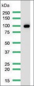 Anti-CD10 antibody, Rabbit monoclonal recombinant, expressed in proprietary host, clone SP179, affinity isolated antibody