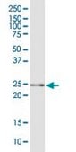 Anti-GSTA5 antibody produced in mouse purified immunoglobulin, buffered aqueous solution
