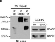 Anti-Histone Deacetylase 2 (HDAC2) antibody, Mouse monoclonal clone HDAC2-62, purified from hybridoma cell culture
