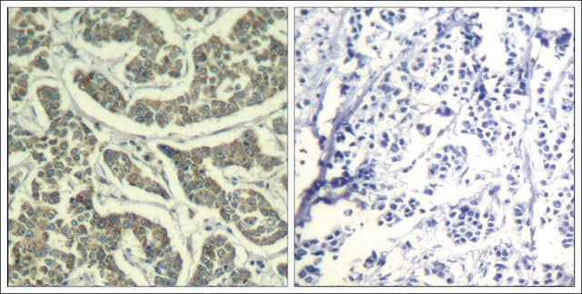 Anti-ATR (Ab-428) antibody produced in rabbit affinity isolated antibody
