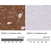 Anti-EPB41L1 antibody produced in rabbit Prestige Antibodies&#174; Powered by Atlas Antibodies, affinity isolated antibody, buffered aqueous glycerol solution