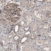 Anti-UTRN antibody produced in rabbit Prestige Antibodies&#174; Powered by Atlas Antibodies, affinity isolated antibody, buffered aqueous glycerol solution
