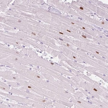 Anti-Adss1 Antibody Produced In Rabbit Prestige Antibodies&#174; Powered by Atlas Antibodies, affinity isolated antibody, buffered aqueous glycerol solution