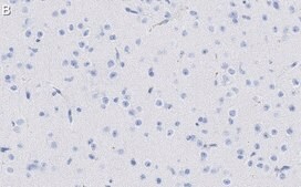 Anti-MAP2 Antibody, clone AP20 ZooMAb&#174; Mouse Monoclonal recombinant, expressed in HEK 293 cells