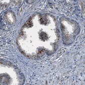 Anti-STARD3NL antibody produced in rabbit Prestige Antibodies&#174; Powered by Atlas Antibodies, affinity isolated antibody, buffered aqueous glycerol solution