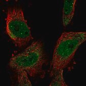 Anti-SUMO2 antibody produced in rabbit Prestige Antibodies&#174; Powered by Atlas Antibodies, affinity isolated antibody, buffered aqueous glycerol solution