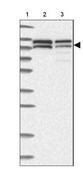 Anti-NVL antibody produced in rabbit Prestige Antibodies&#174; Powered by Atlas Antibodies, affinity isolated antibody, buffered aqueous glycerol solution