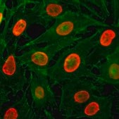 Anti-Acetyl-Histone H3 (Lys9) antibody, Rabbit monoclonal recombinant, expressed in HEK 293 cells, clone RM161, purified immunoglobulin