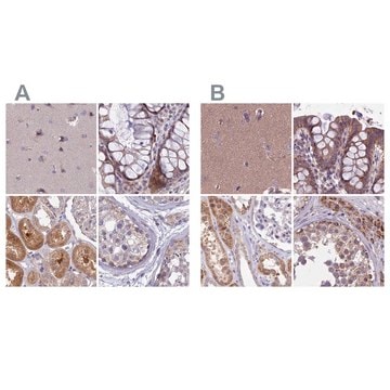 Anti-DUS2 antibody produced in rabbit Prestige Antibodies&#174; Powered by Atlas Antibodies, affinity isolated antibody, buffered aqueous glycerol solution