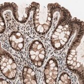 Anti-NR5A2 antibody produced in rabbit Ab1, Prestige Antibodies® Powered by Atlas Antibodies, affinity isolated antibody, buffered aqueous glycerol solution