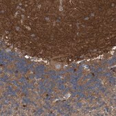 抗-CORO2B 兔抗 Prestige Antibodies&#174; Powered by Atlas Antibodies, affinity isolated antibody, buffered aqueous glycerol solution