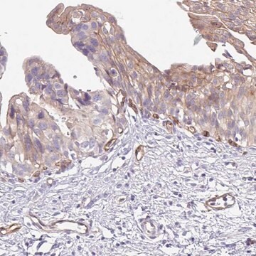 Anti-EHD4 antibody produced in rabbit Prestige Antibodies&#174; Powered by Atlas Antibodies, affinity isolated antibody, buffered aqueous glycerol solution