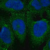 Anti-APBB1 antibody produced in rabbit Prestige Antibodies&#174; Powered by Atlas Antibodies, affinity isolated antibody, buffered aqueous glycerol solution