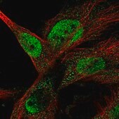 Anti-ANKRD42 antibody produced in rabbit Prestige Antibodies&#174; Powered by Atlas Antibodies, affinity isolated antibody, buffered aqueous glycerol solution