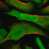 Anti-MAGED2 antibody produced in rabbit Prestige Antibodies&#174; Powered by Atlas Antibodies, affinity isolated antibody, buffered aqueous glycerol solution, ab2