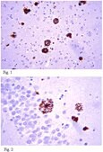 Anti-Amyloid &#946;42 Antibody, clone G2-13 clone G2-13, from mouse