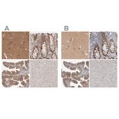 Anti-WIPF2 antibody produced in rabbit Prestige Antibodies&#174; Powered by Atlas Antibodies, affinity isolated antibody, buffered aqueous glycerol solution, Ab2