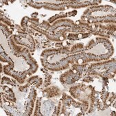 Anti-OFD1 antibody produced in rabbit Prestige Antibodies&#174; Powered by Atlas Antibodies, affinity isolated antibody, buffered aqueous glycerol solution