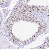 Anti-MCM2 antibody produced in rabbit Prestige Antibodies&#174; Powered by Atlas Antibodies, affinity isolated antibody, buffered aqueous glycerol solution