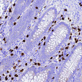 Anti-IL2RG antibody produced in rabbit Prestige Antibodies® Powered by Atlas Antibodies, affinity isolated antibody, buffered aqueous glycerol solution