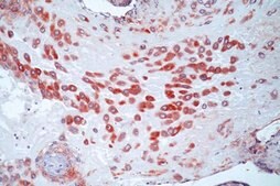 抗MMP-2前体抗体，NT，克隆CA-4001 clone CA-4001, Chemicon®, from mouse