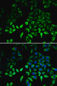 Anti-PKM antibody produced in rabbit