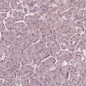 Anti-SAT2 antibody produced in rabbit Prestige Antibodies&#174; Powered by Atlas Antibodies, affinity isolated antibody, buffered aqueous glycerol solution