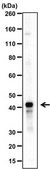 Anti-CLEC7A (Dectin-1) Antibody from rabbit, purified by affinity chromatography