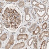 Anti-FGF1 antibody produced in rabbit Prestige Antibodies® Powered by Atlas Antibodies, affinity isolated antibody, buffered aqueous glycerol solution