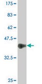 Monoclonal Anti-NEUROD2 antibody produced in mouse clone 3E7, purified immunoglobulin, buffered aqueous solution
