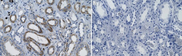 Anti-Hexokinase 1 Antibody, clone 3B19 ZooMAb&#174; Rabbit Monoclonal recombinant, expressed in HEK 293 cells