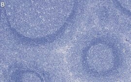 Anti-Talin-1 Antibody, clone 2F8 ZooMAb&#174; Rabbit Monoclonal recombinant, expressed in HEK 293 cells