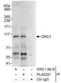 Rabbit anti-ORC1 Antibody, Affinity Purified Powered by Bethyl Laboratories, Inc.