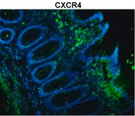 Anti-CXCR4 (N-terminal) antibody produced in rabbit affinity isolated antibody