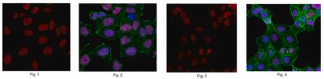 Anti-Chromobox protein homolog 5 Antibody from rabbit, purified by affinity chromatography