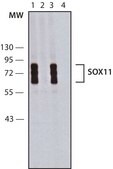 Anti-SOX11 antibody produced in rabbit ~1.0 mg/mL, affinity isolated antibody