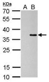 Monoclonal Anti-COL11A2 antibody produced in mouse clone GT473, affinity isolated antibody