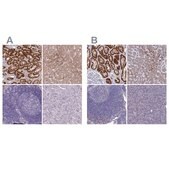 Anti-AK4 antibody produced in rabbit Prestige Antibodies&#174; Powered by Atlas Antibodies, affinity isolated antibody, buffered aqueous glycerol solution