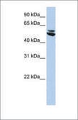Anti-KRT7 antibody produced in rabbit affinity isolated antibody