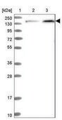 Anti-NUP155 antibody produced in rabbit Prestige Antibodies® Powered by Atlas Antibodies, affinity isolated antibody, buffered aqueous glycerol solution