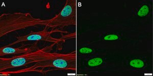 Anti-CHD4 Antibody, clone 1C17 ZooMAb® Rabbit Monoclonal recombinant, expressed in HEK 293 cells