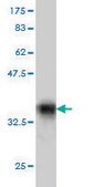 Monoclonal Anti-PTGIR antibody produced in mouse clone 4B10, purified immunoglobulin, buffered aqueous solution