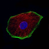 Monoclonal Anti-TRPM4 antibody produced in mouse Prestige Antibodies® Powered by Atlas Antibodies, clone CL11214, purified antibody (Protein A)